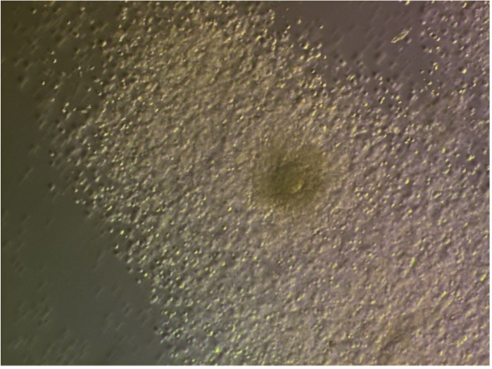 An egg with its supporting cells