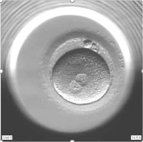 Two polar bodies and two pronuclei