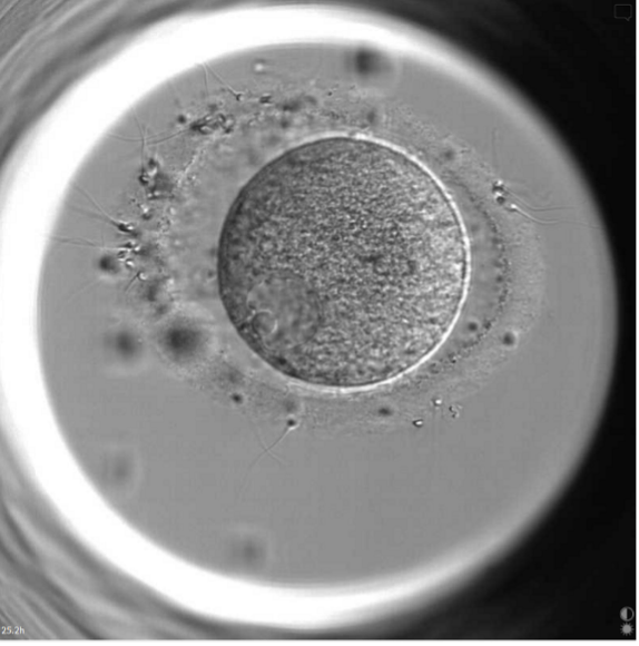 An egg at the very immature germinal vesicle stage