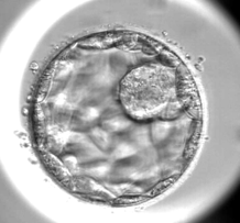 Embryo