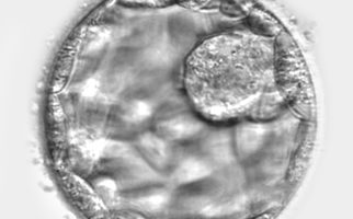 Image of a blastocyst (a day 5–6 embryo). The cells on the outside become placental tissue and the group of cells in the middle develop into a foetus.