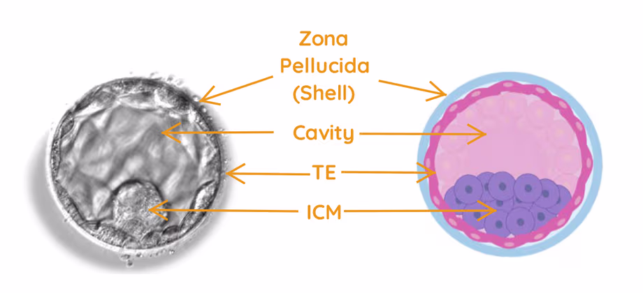 A photographic image of a blastocyst (left) positioned next to a graphic representation of a blastocyst (right). The images show the types of cells that go on to become an embryo proper (foetus), including the zona pellucida (shell), cavity, trophectoderm cells (TE) and inner cell mass (ICM).